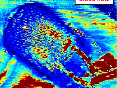Luba Perry Doppler Image