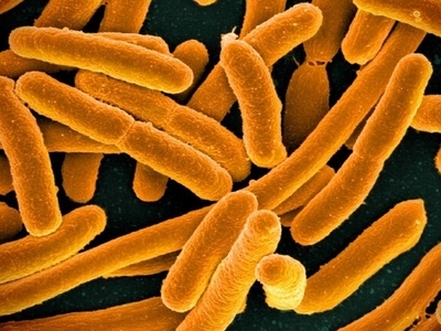 Disinfecting pathogens E coli credit N